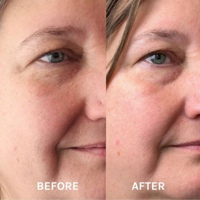 Peeling AHA Maske mit Vitamin C - Miracle Mask