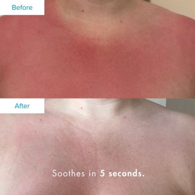 After Sun Lotion mit Aloe Vera & Hagebutten�l