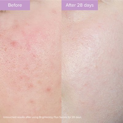 Ansiktsserum med Niacinamid - Brightening Plus Serum